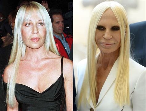 did donatella versace have plastic surgery|Donatella Versace's Plastic Surgery Transformations .